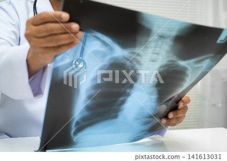 Doctor examining lung radiography xray film. 141613031