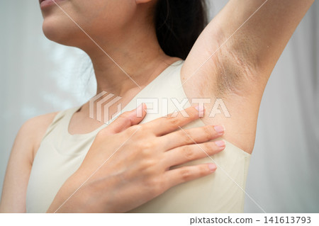 Asian woman have problem black armpit beauty skin care. Asian woman have problem black armpit beauty skin care. 141613793