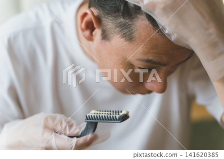 A man in his 40s dyes his gray hair at home. A man in his 40s dyes his gray hair at home. 141620385