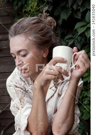 Mature woman with vitiligo skin and gray hair. Female with autoimmune disease. pigmentation. scene radiates tranquility, self love, and body positivity, capturing the essence of embracing Mature woman with vitiligo skin and gray hair. Female with autoimmune disease. pigmentation. scene radiates tranquility, self love, and body positivity, capturing the essence of embracing 141635040
