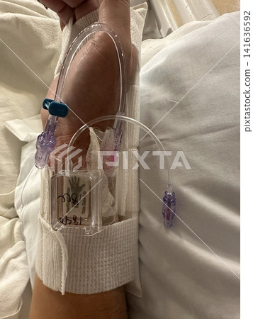 Close-up of an intravenous line inserted into the hand of a hospitalized patient. Close-up of an intravenous line inserted into the hand of a hospitalized patient. 141636592