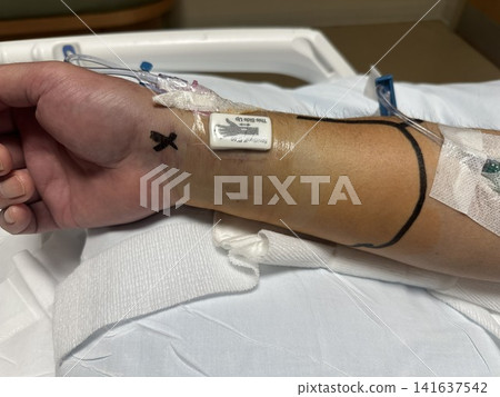 導管治療後腕部腫脹和皮下出血:配戴止血裝置時的術後管理。 導管治療後腕部腫脹和皮下出血:配戴止血裝置時的術後管理。 141637542