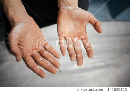 Chalk Covered Male Climber Hands After Hard Route: Close Up Of Worn Fingers And Taped Skin Chalk Covered Male Climber Hands After Hard Route: Close Up Of Worn Fingers And Taped Skin 141639120