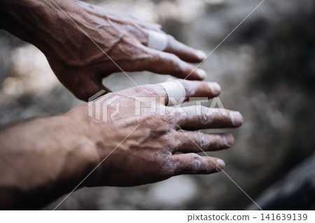 Chalk Covered Male Climber Hands After Hard Route: Close Up Of Worn Fingers And Taped Skin Outdoors Chalk Covered Male Climber Hands After Hard Route: Close Up Of Worn Fingers And Taped Skin Outdoors 141639139