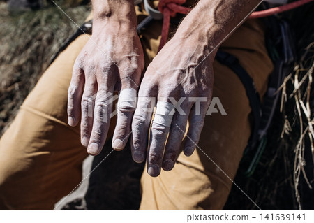 Chalk Covered Male Climber Hands After Hard Route: Close Up Of Worn Fingers And Taped Skin Outdoors Chalk Covered Male Climber Hands After Hard Route: Close Up Of Worn Fingers And Taped Skin Outdoors 141639141