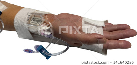 導尿管治療後的手，有止血帶和靜脈輸液管（透明背景 PNG） 141640286