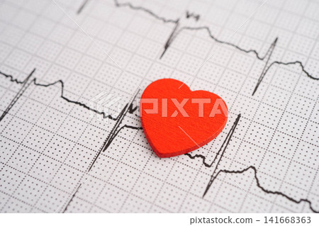 Electrocardiogram ECG, heart wave, heart attack, cardiogram report. 141668363