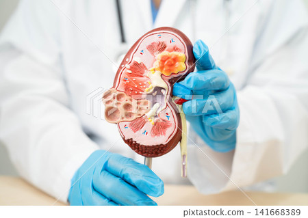 Chronic kidney disease, doctor with model for treatment urinary system, urology, Estimated glomerular filtration rate eGFR. Chronic kidney disease, doctor with model for treatment urinary system, urology, Estimated glomerular filtration rate eGFR. 141668389