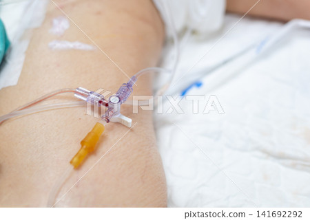 Closeup of intravenous catheter inserted patient arm during hospital treatment highlighting medical care infusion therapy recovery clinical procedure healthcare support Closeup of intravenous catheter inserted patient arm during hospital treatment highlighting medical care infusion therapy recovery clinical procedure healthcare support 141692292
