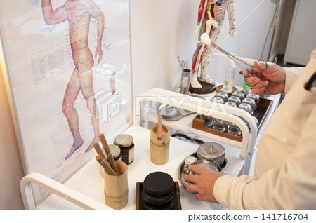 At the acupuncture clinic, a white-coated practitioner holds forceps with a cotton swab. At the acupuncture clinic, a white-coated practitioner holds forceps with a cotton swab. 141716704