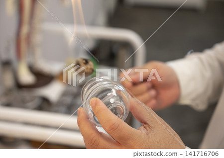 Close-up of a practitioner holding a clear glass jar and a burning cotton swab 141716706