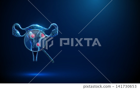 3D blue uterus and magnifying glass with viruses inside. Gynecology, viral infection, HPV diagnosis, women health, sexual disease, pathogen virus detection concept 3D blue uterus and magnifying glass with viruses inside. Gynecology, viral infection, HPV diagnosis, women health, sexual disease, pathogen virus detection concept 141730653