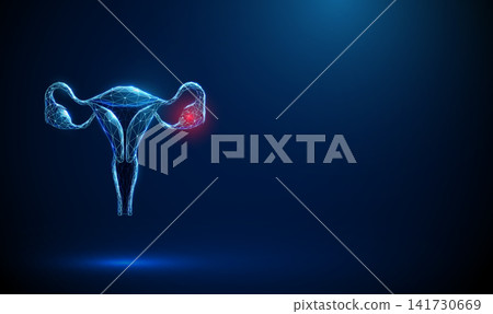 3D blue uterus with red spot. Gynecology, ovarian cancer, tumor growth, women health, reproductive care medicine, oncology screening, early lesion diagnosis concept 141730669