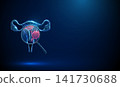 3D blue uterus and magnifying glass with tumor. Oncology, cervical cancer, tumor detection, gynecology, women health, malignant growth, diagnosis screening concept 141730688