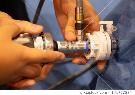 Endoscopic surgery Endoscopic surgery 141752884