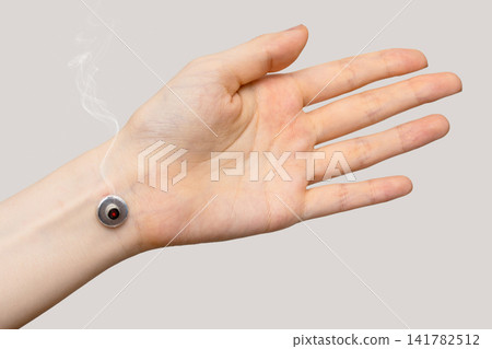 A burning moxibustion device on the inside of a woman's wrist and her open hand A burning moxibustion device on the inside of a woman's wrist and her open hand 141782512