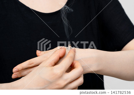 A statue of a woman's hand touching a moxa cone on the back of her hand. A statue of a woman's hand touching a moxa cone on the back of her hand. 141782536