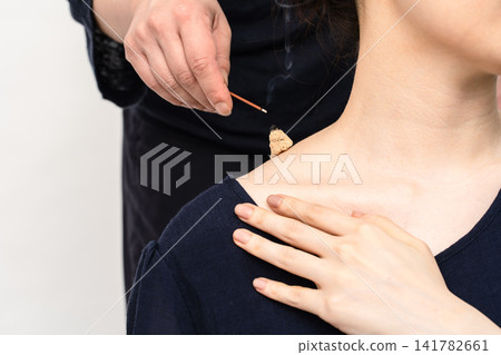 一名女子在頸肩部位進行艾灸治療時點燃一根香。 一名女子在頸肩部位進行艾灸治療時點燃一根香。 141782661