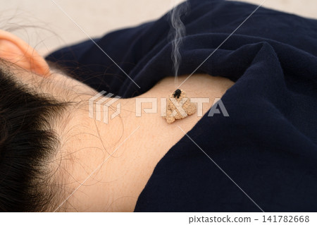 A burning cone-shaped moxa cone is smoking on the nape of a woman's neck. A burning cone-shaped moxa cone is smoking on the nape of a woman's neck. 141782668