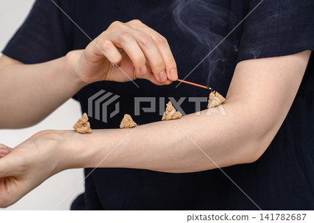 A woman lights incense sticks one after another on three moxibustion points on her forearm. A woman lights incense sticks one after another on three moxibustion points on her forearm. 141782687