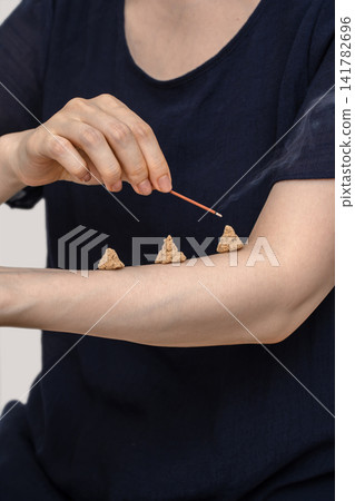 A woman brings an incense stick close to her forearm, where three moxa cones are placed side by side. A woman brings an incense stick close to her forearm, where three moxa cones are placed side by side. 141782696