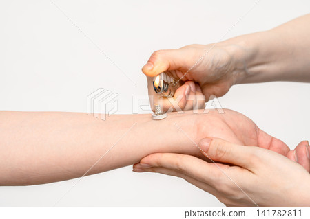 A female acupuncturist lights the moxa on the patient's wrist. 141782811