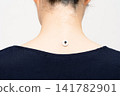 A burning moxibustion device is smoking on the nape of a woman's neck. 141782901