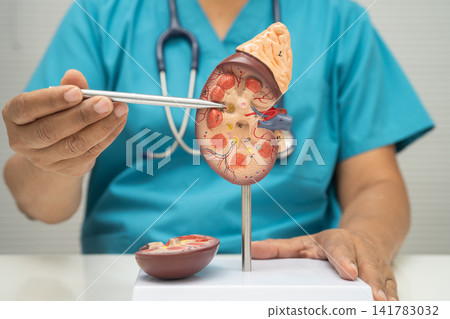 Chronic kidney disease, Asian woman with model for treatment urinary system, urology, Estimated glomerular filtration rate eGFR. Chronic kidney disease, Asian woman with model for treatment urinary system, urology, Estimated glomerular filtration rate eGFR. 141783032