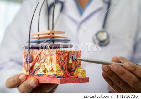 Asian dermatologist doctor holding skin structure model anatomy for treatment in hospital, hair transplant. 141816730