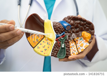 Cirrhosis, Liver cancer, fatty liver, Asian doctor with liver human model. Cirrhosis, Liver cancer, fatty liver, Asian doctor with liver human model. 141816731
