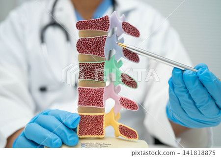 Doctor holding osteoporosis in back bone model for treatment medical. Doctor holding osteoporosis in back bone model for treatment medical. 141818875