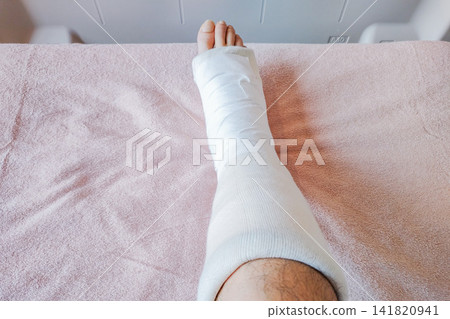 右腳在跟腱斷裂手術後打著石膏（從上到下） 141820941
