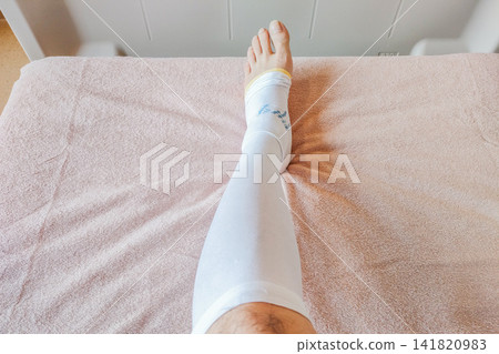 Left (top view): Wearing compression stockings to prevent blood clots before surgery. Left (top view): Wearing compression stockings to prevent blood clots before surgery. 141820983