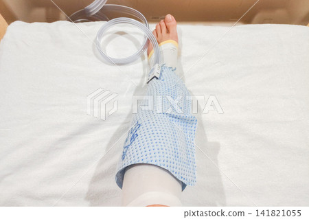 左腳(從上方看)裝有氣動按摩醫療裝置,用於預防血栓。 左腳(從上方看)裝有氣動按摩醫療裝置,用於預防血栓。 141821055
