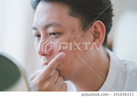 Middle-aged men who treat blemishes Middle-aged men who treat blemishes 141836315