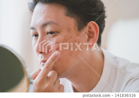 A 40-year-old man with a troubled face, looking at the blemishes on his cheeks in a tabletop mirror, discusses his skincare routine. A 40-year-old man with a troubled face, looking at the blemishes on his cheeks in a tabletop mirror, discusses his skincare routine. 141836316
