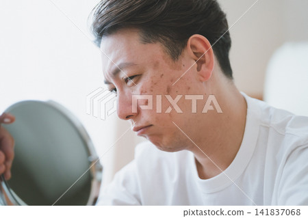 一名40歲的男子在進行皮膚檢查時,對著桌面上的鏡子仔細檢查臉頰上的瑕疵。 一名40歲的男子在進行皮膚檢查時,對著桌面上的鏡子仔細檢查臉頰上的瑕疵。 141837068