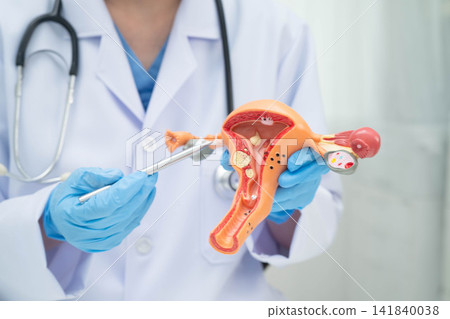 Uterus, doctor holding human anatomy model for study diagnosis and treatment in hospital. Uterus, doctor holding human anatomy model for study diagnosis and treatment in hospital. 141840038