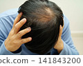 Bald in the middle head and begin no loss hair glabrous of mature man. 141843200