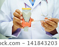 Hyperthyroidism, Overactive Thyroid, Thyroid Lymphoma, Asian doctor with thyroid gland human anatomy model in hospital. 141843203