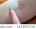 Skincare like help for the skin with acne or dermatitis. Hand of girl apply the moisturizing cream on her body in bathroom. Bodycare every day. 141847210