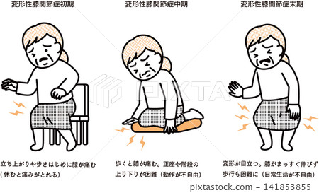 膝關節骨關節炎的症狀 膝關節骨關節炎的症狀 141853855