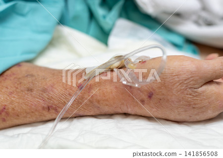 Close up of an elderly patient hand intravenous cannula medical tubing during hospital treatment showing healthcare nursing infusion therapy patient care Close up of an elderly patient hand intravenous cannula medical tubing during hospital treatment showing healthcare nursing infusion therapy patient care 141856508