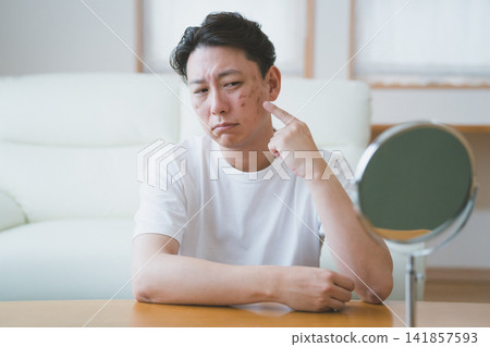 一位四十多歲的男子站在桌上鏡前,指著臉頰上的瑕疵,擔心如何照顧瑕疵。 一位四十多歲的男子站在桌上鏡前,指著臉頰上的瑕疵,擔心如何照顧瑕疵。 141857593