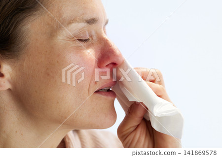 Woman with Allergy Symptoms and Red Nose 141869578