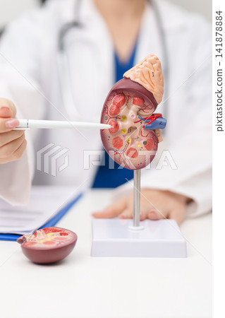 Doctor with Kidney Adrenal gland anatomy model. disease of Urinary system and Stones, Cancer, world kidney day, Chronic kidney, Urology, Nephritis, Renal, Transplant and health concept 141878884