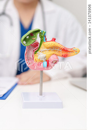 Doctor with human Pancreatitis anatomy model with Pancreas, Gallbladder, Bile Duct, Duodenum, Small intestine. Pancreatic cancer, Acute and Chronic pancreatitis, Digestive system and Health concept Doctor with human Pancreatitis anatomy model with Pancreas, Gallbladder, Bile Duct, Duodenum, Small intestine. Pancreatic cancer, Acute and Chronic pancreatitis, Digestive system and Health concept 141878906