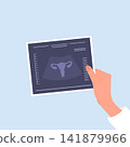 Uterus health. Female hand holding ultrasound result. Medical diagnosis and treatment for uterine diseases, cancer or endometriosis. Vector illustration in flat style 141879966