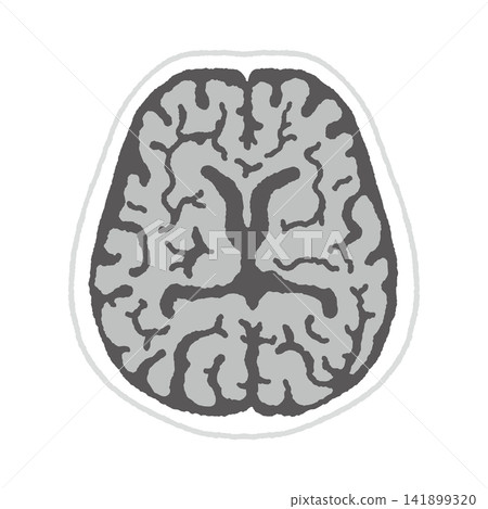 X-ray of the brain X-ray of the brain 141899320