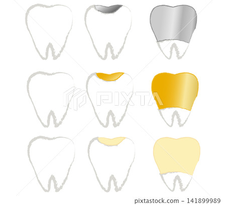 Illustrations of dental crowns: silver, gold, and ceramic. Illustrations of dental crowns: silver, gold, and ceramic. 141899989